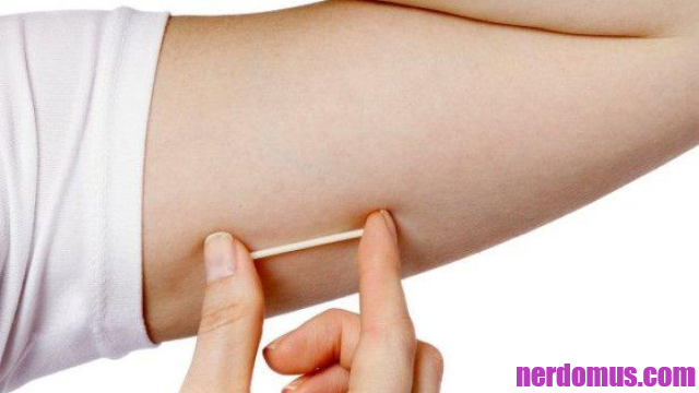 Efek Samping KB Implan Kepada Para Wanita, Salah Satunya Bikin Gemuk!