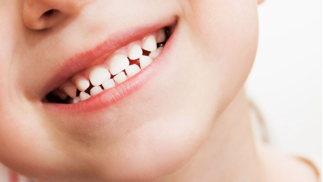 5 Tips Menjaga Kesehatan Gigi dan Gusi yang Efektif Menurut Pakar Kesehatan